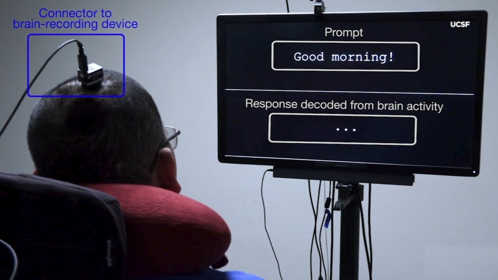 UCSF brain technology gives nonverbal paralysis patient speech - KGO-TV